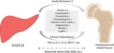 Association of Nonalcoholic Fatty Liver Disease With Osteoporotic Fractures: A Cross-Sectional Retrospective Study of Chinese Individuals